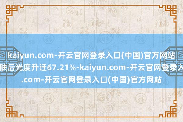 kaiyun.com-开云官网登录入口(中国)官方网站同期确保使用后皮肤后光度升迁67.21%-kaiyun.com-开云官网登录入口(中国)官方网站